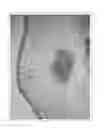 Fig. 07 - METHOD FOR PRODUCING ANIMAL MODEL OF OSTEOBLASTIC BONE METASTASIS