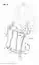 Fig. 09 - Compartmentalized hand warmer
