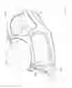 Fig. 45 - Surface cleaning apparatus