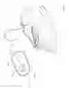 Fig. 59 - Surface cleaning apparatus