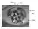 Fig. 01 - Full-eye illumination ocular surface imaging of an ocular tear film for determining tear film thickness and/or providing ocular topography