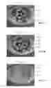 Fig. 08 - Full-eye illumination ocular surface imaging of an ocular tear film for determining tear film thickness and/or providing ocular topography