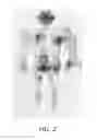 Fig. 03 - IGLASS: INFRARED THERMOGRAPHY FOR LEARNING THERMOREGULATION PERFORMANCE