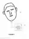 Fig. 02 - Bruxism Detection System With Chin-Mounted Accelerometer Sensor