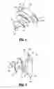 Fig. 02 - Articulating apparatus for endoscopic procedures with timing system