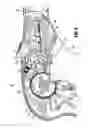 Fig. 07 - Articulating apparatus for endoscopic procedures with timing system