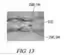 Fig. 10 - Clot retrieval system