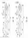 Fig. 110 - Clot retrieval system