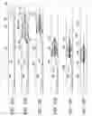 Fig. 33 - Clot retrieval system