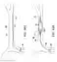 Fig. 47 - Clot retrieval system