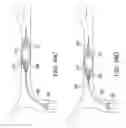 Fig. 48 - Clot retrieval system
