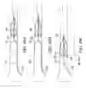 Fig. 67 - Clot retrieval system