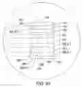 Fig. 83 - Clot retrieval system