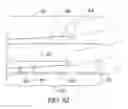 Fig. 95 - Clot retrieval system