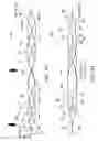 Fig. 96 - Clot retrieval system