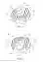 Fig. 02 - Cervical spine spacer
