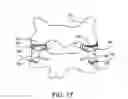 Fig. 09 - Cervical spine spacer