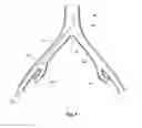 Fig. 02 - Introducer for a side branch device