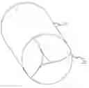 Fig. 01 - Percutaneously implantable replacement heart valve device and method of making same