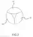 Fig. 03 - Percutaneously implantable replacement heart valve device and method of making same