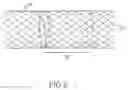 Fig. 07 - Percutaneously implantable replacement heart valve device and method of making same