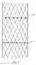 Fig. 09 - Percutaneously implantable replacement heart valve device and method of making same