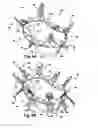Fig. 06 - Implantable cardiovascular valve