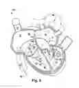 Fig. 09 - Implantable cardiovascular valve