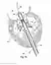 Fig. 17 - Implantable cardiovascular valve