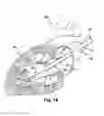 Fig. 19 - Implantable cardiovascular valve