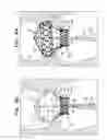Fig. 09 - Articulatable prosthetic valve