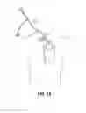 Fig. 09 - Vascular device for treating venous valve insufficiency
