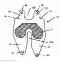 Fig. 01 - Resilient knee implant and methods