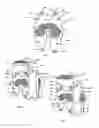 Fig. 02 - Resilient knee implant and methods