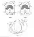 Fig. 03 - Resilient knee implant and methods