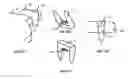 Fig. 08 - Resilient knee implant and methods