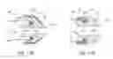 Fig. 45 - Intragastric device for treating obesity