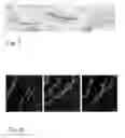 Fig. 09 - Ocular therapeutics tool