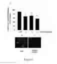 Fig. 09 - Method of treating chronic obstructive pulmonary disease (CPD) with verproside