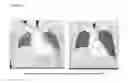 Fig. 03 - METHODS OF TREATING CANCERS WITH THERAPEUTIC NANOPARTICLES