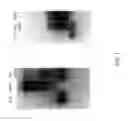 Fig. 02 - Particles comprising single stranded RNA and double stranded RNA for immunomodulation