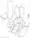 Fig. 07 - Airway assist device and method