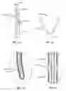 Fig. 09 - Pacing guidewire