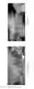 Fig. 02 - High aspect ratio layered double hydroxide materials and methods for preparation thereof