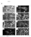 Fig. 05 - PROLONGATION OF SURVIVAL OF AN ALLOGRAFT BY INHIBITING COMPLEMENT ACTIVITY