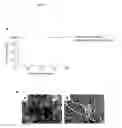 Fig. 12 - PROLONGATION OF SURVIVAL OF AN ALLOGRAFT BY INHIBITING COMPLEMENT ACTIVITY