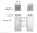 Fig. 09 - Protein assay method specific to TRACP-5b (tartrate resistant acid phosphatase 5b)