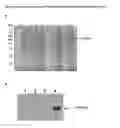 Fig. 05 - Polynucleotide for recombinant expression of sucrose isomerase