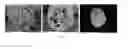 Fig. 01 - AQUEOUS THERMOSETTING URETHANE COMPOUND FOR YARN COATING AND METHOD OF MANUFACTURING COATED YARN USING THE SAME