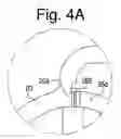 Fig. 08 - Torque converter and hydrokinetic torque coupling device having core lockup clutch, and related methods
